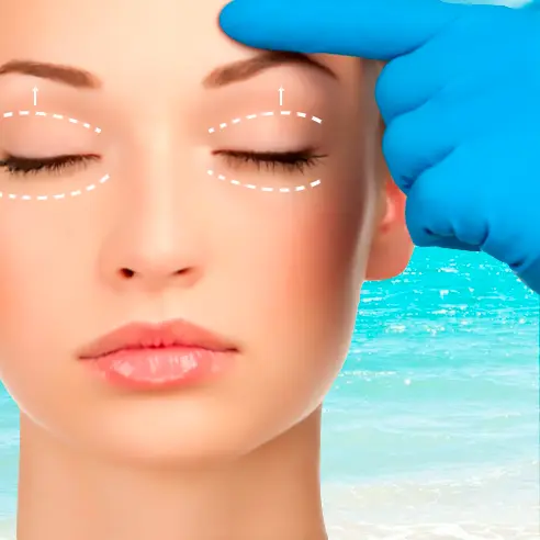 Eyelid Lift (Blepharoplasty) in Cancun