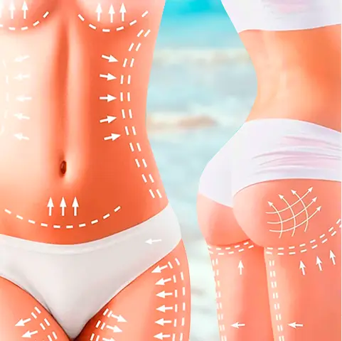 Mommy Makeover in Cancun